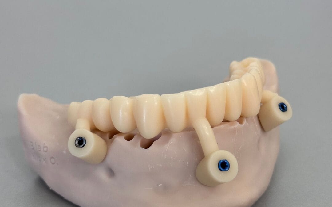 Dental Implants Collingwood
