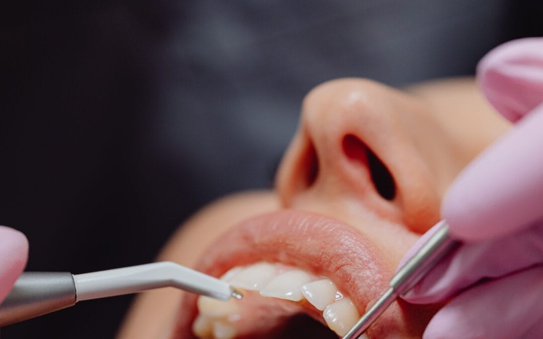 Emergency Dentist Newmarket