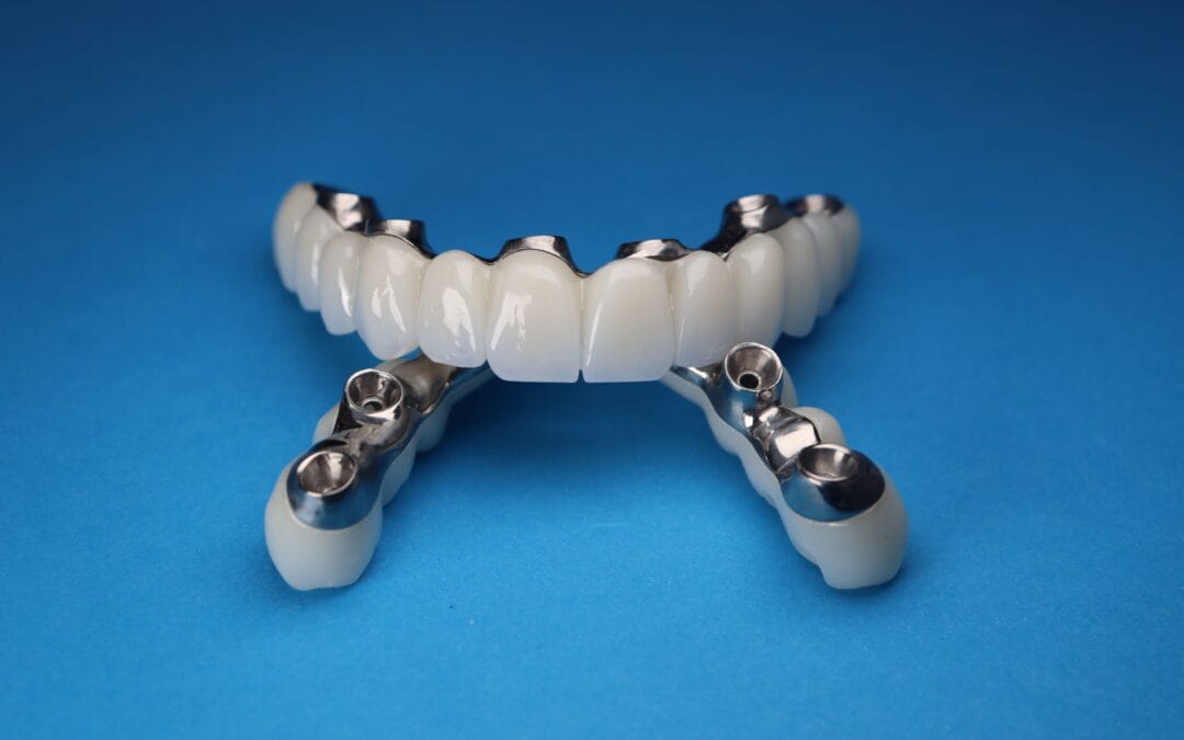 Dental Implants Collingwood